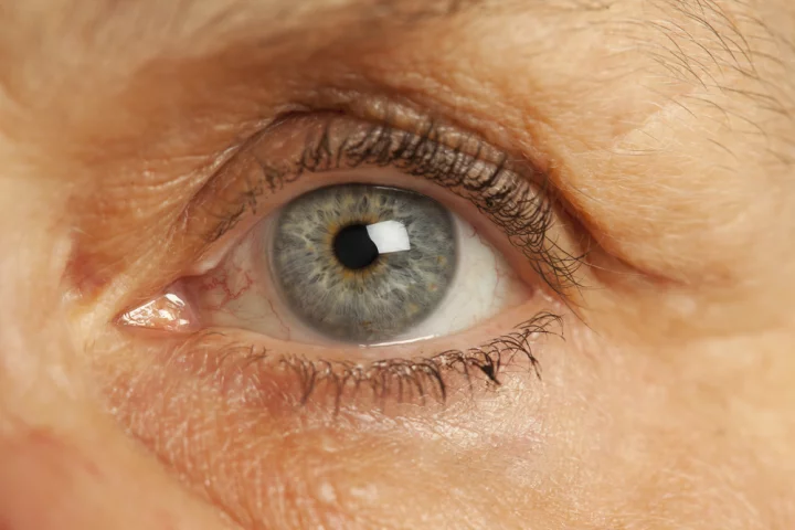 The implant measures internal optic pressure, excessive amounts of which can lead to loss of vision (Photo: Shutterstock)