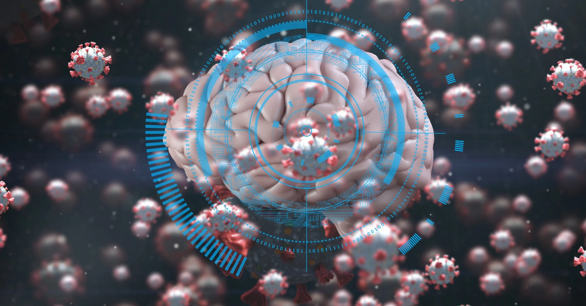 The team of neuroscientists suggest there is evidence catching COVID-19 could increase one's risk of developing Parkinson's disease