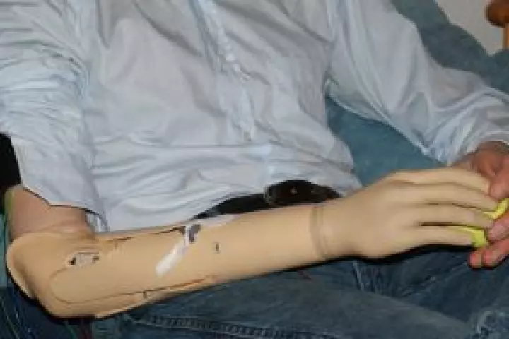 The new development from Jena provides the upper arm with sensory information which is then transmitted to the brain. This reduces phantom pain (Photo: Sandra Preissler/FSU)