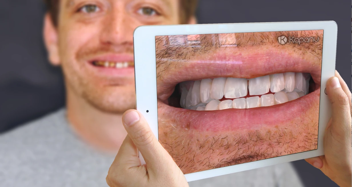 Kapanu actually showed off its augmented reality software at the International Dental Show in Germany earlier this year