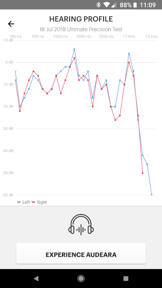 My hearing curve, as measured by the Audeara A-01 system's built-in hearing test