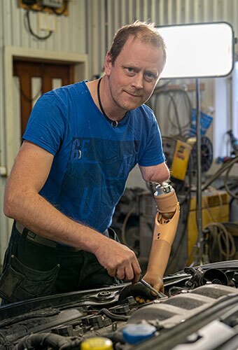 Mind Controlled Prosthetic Arms Feel Like The Real Thing