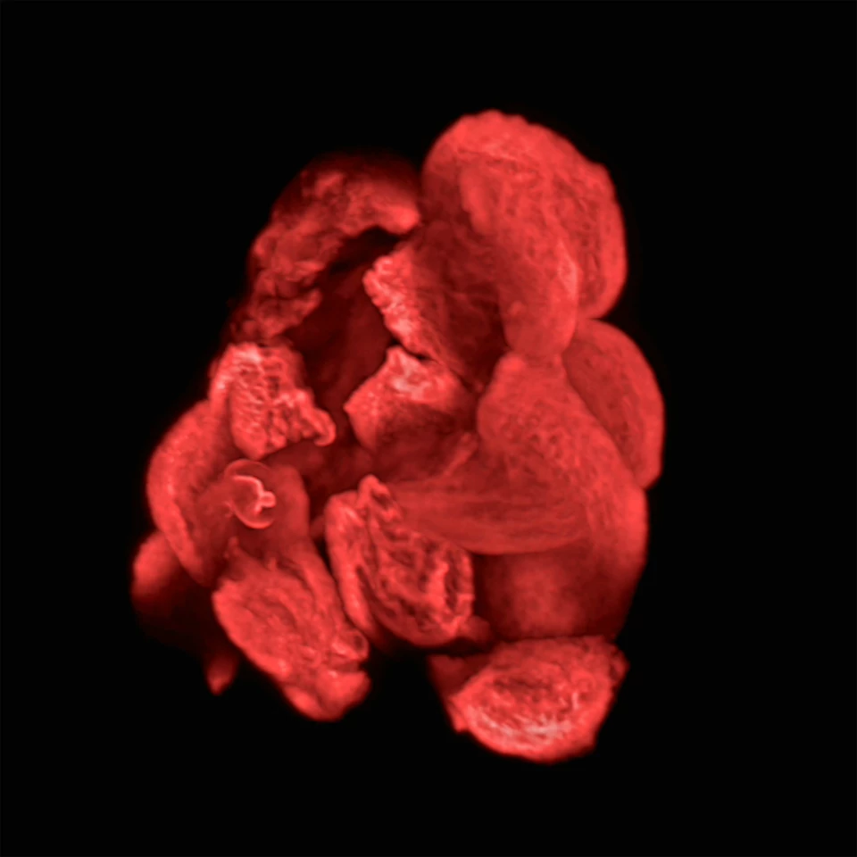 Third place went to "Roses are Red," a cluster of cells grown directly from a patient's tumor