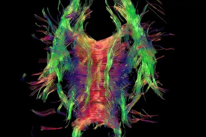 An image of a brain's wiring system, acquired using the new software
