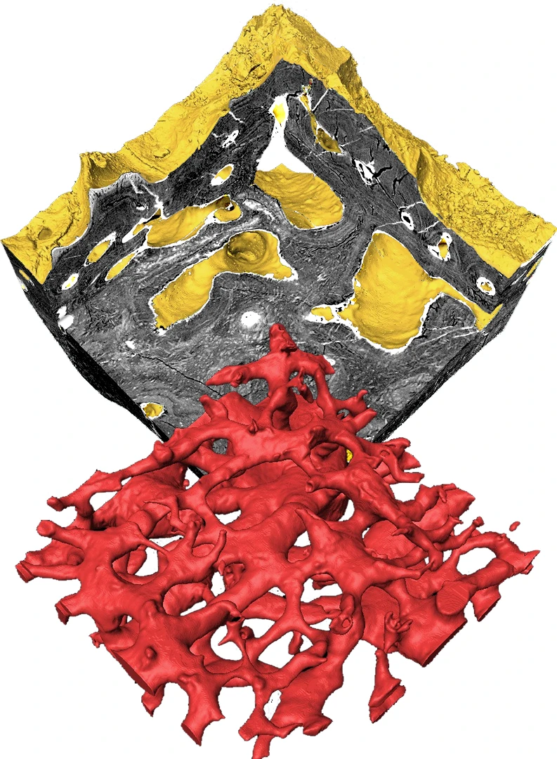 The researchers examined the heterostracan skeleton closely using Synchrotron Tomography to identify the structure and finally determine what type of tissue aspidin is