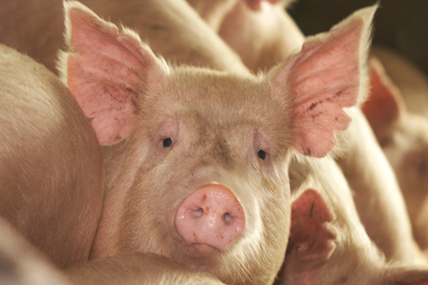 Livecell pig skin successfully used to treat human burn wound