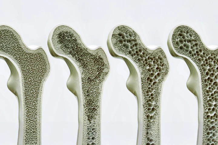 Scientists have discovered a way to significantly improve bone strength