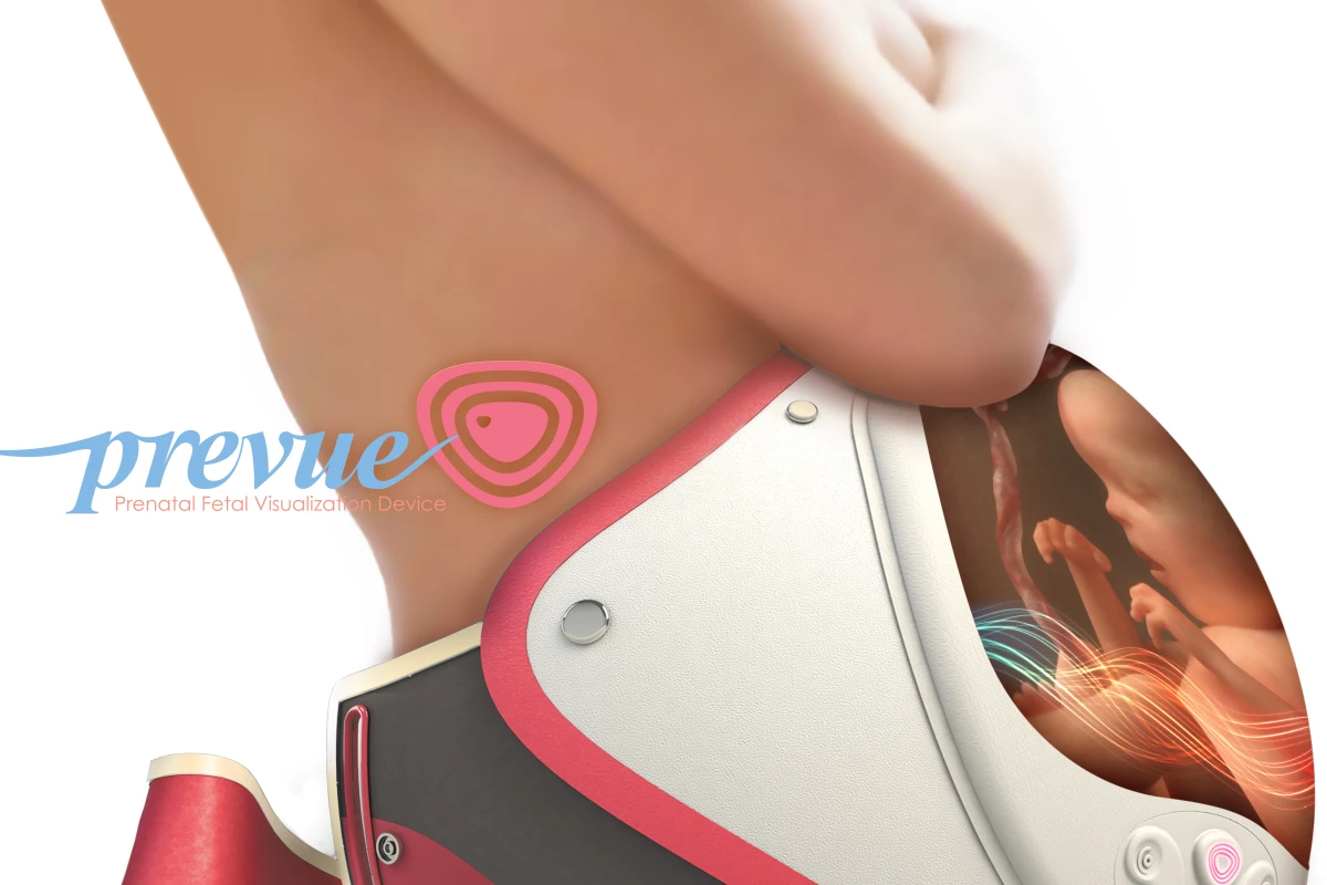 The PreVue concept from industrial designer Melody Shiue proposes using 4D ultrasound technology to enhance the bond between a growing fetus and its parents