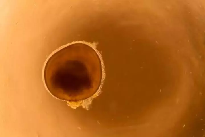 One of the mini eyes grown in the lab in the new study