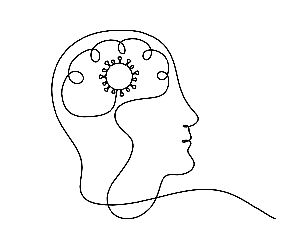 It is still unclear whether COVID-19 is hastening the progression of pre-existing neurodegeneration or prompting new disease