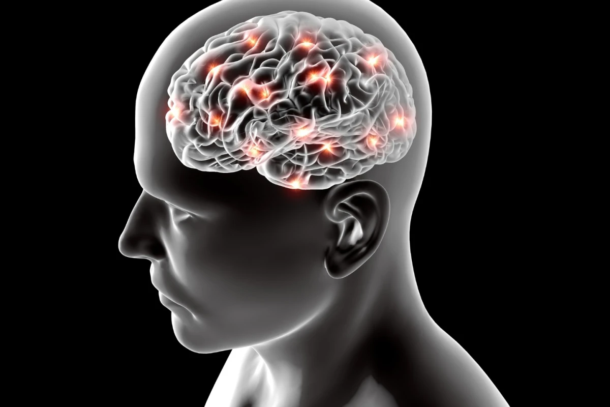 New research suggests obesity that affects the liver could play a part in the long-term onset of Alzheimer's and dementia