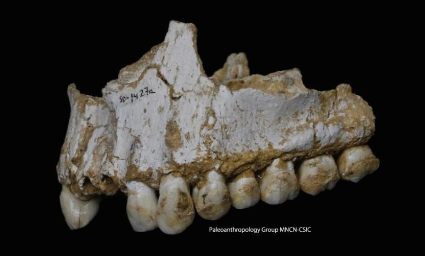 This Neanderthal was found to have several afflictions that would have caused him pain, and traces in his dental plaque indicated he was medicating himself with forms of aspirin and penicillin