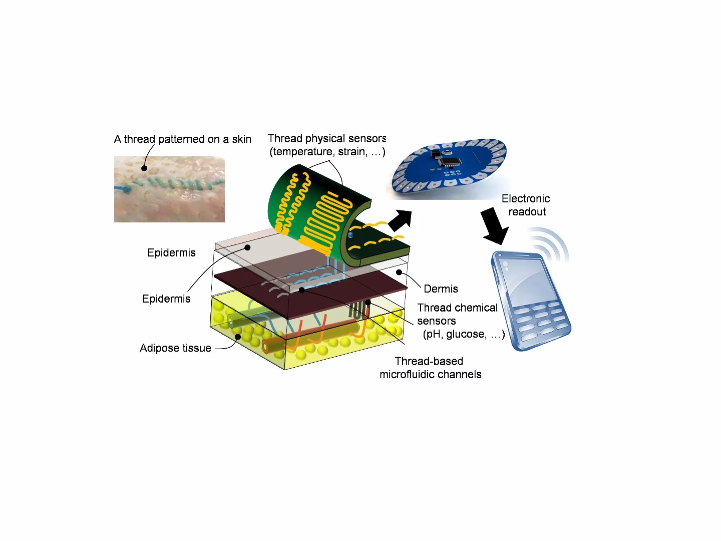 A diagram showing how the smart sutures work