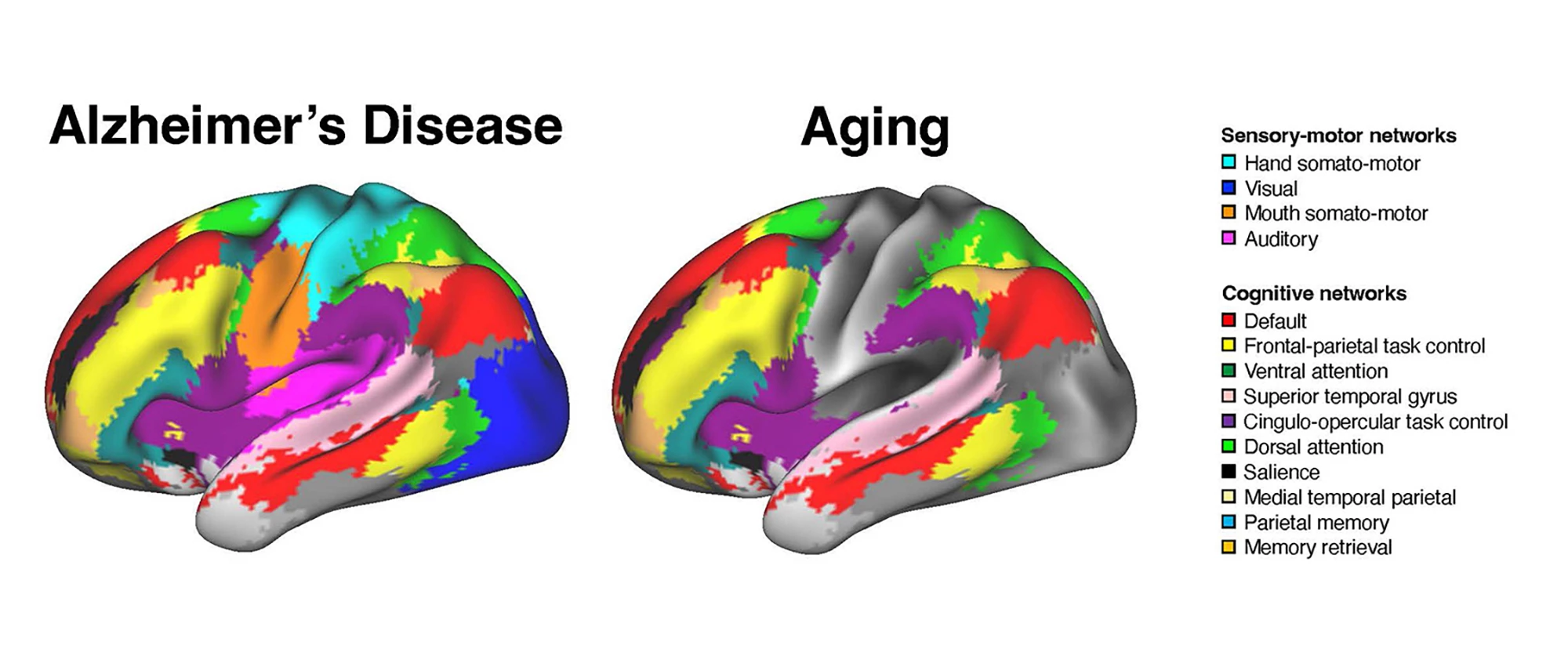 Alzheimer’s disease and aging were associated with distinct patterns of brain network disruption