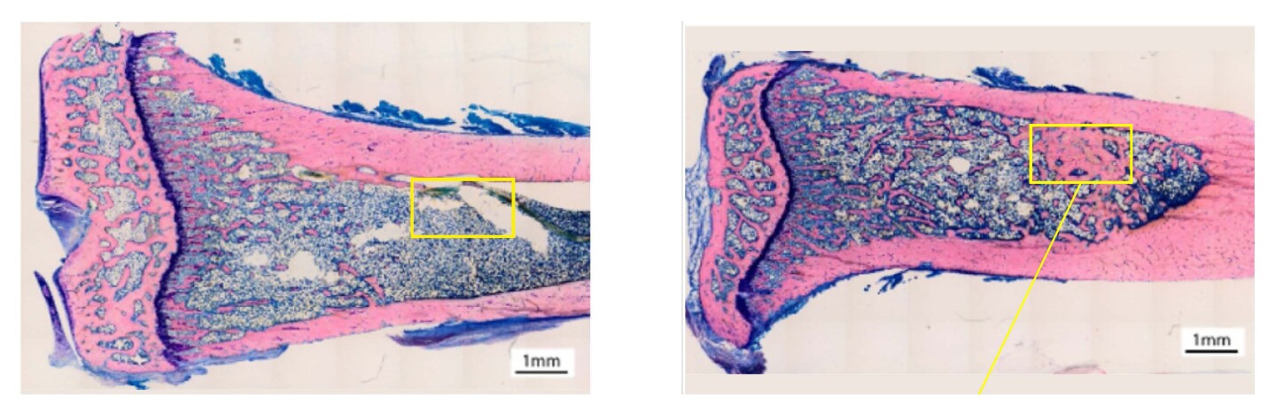 Una comparación del tejido óseo (rosa teñido) de ratas que reciben solo tratamiento con esteroides anabólicos (izquierda) y ratas que reciben tratamiento con esteroides más el hidrogel (derecha)