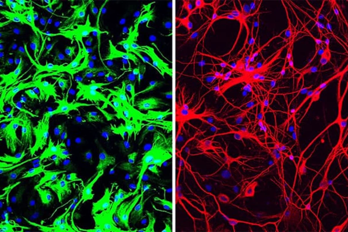 Mouse astrocytes (green) before reprogramming on the left, and on the right after being converted into neurons