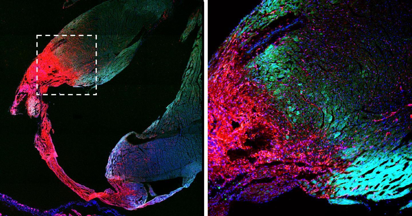 The scar tissue (red) and heart cells (green) in a mouse after a heart attack