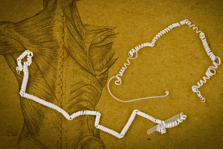 The tiny coils in the fiber developed by MIT researchers curl even tighter when warmed up