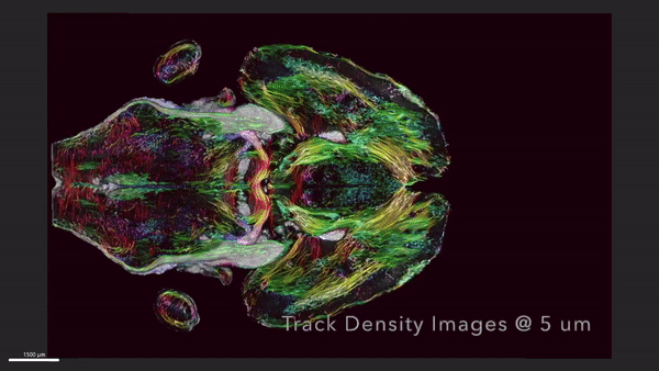The remarkable detail as the scan pieced together horizontal 'slices' of the brain