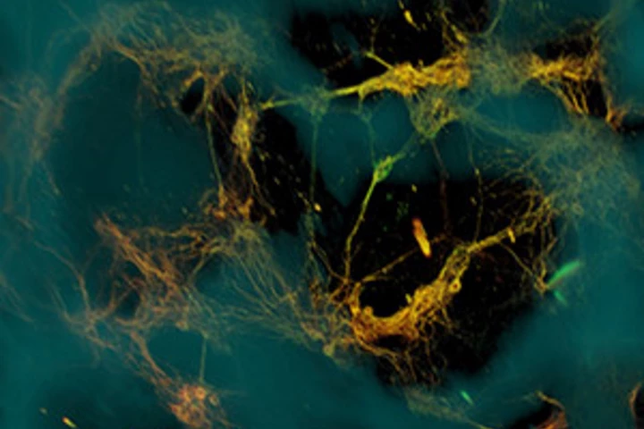 Confocal microscope image of the artificial neural tissue developed at Tufts University