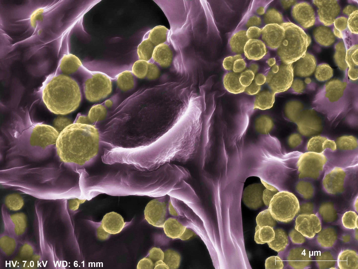 Fashionable fungi: A colored image shows the particles of gold collected by the fungus species fusarium oxsporium