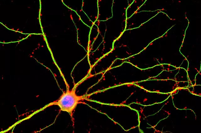 A neuron with the dendrites shown in green