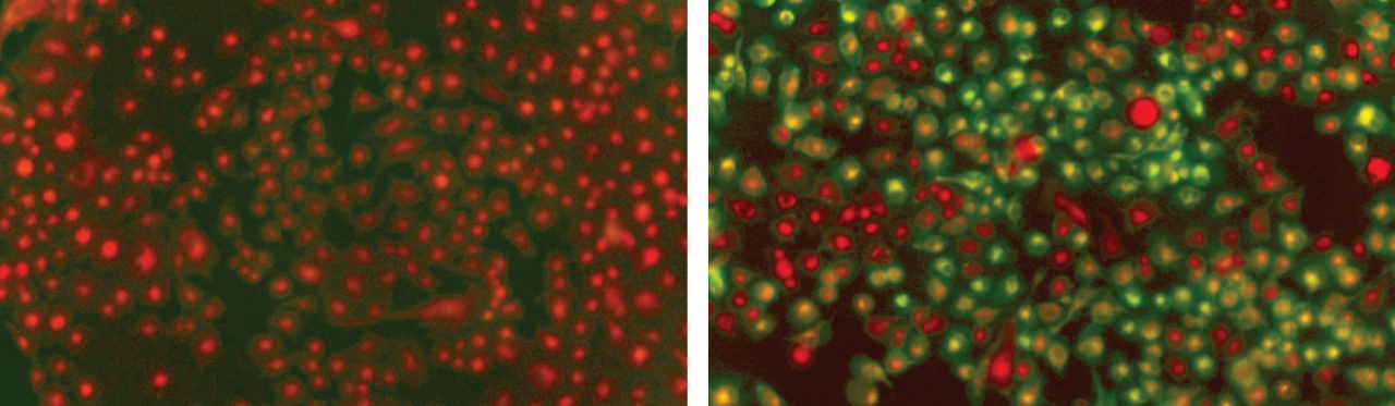 Untreated pancreatic cancer cells can be seen on the left; while the cysteine-starved cells are on the right, with green indicating cellular damage that will eventually kill the cells