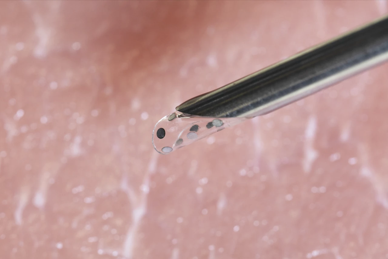 Along with being surgically implanted in the body, the BioSUM can also be injected via a needle