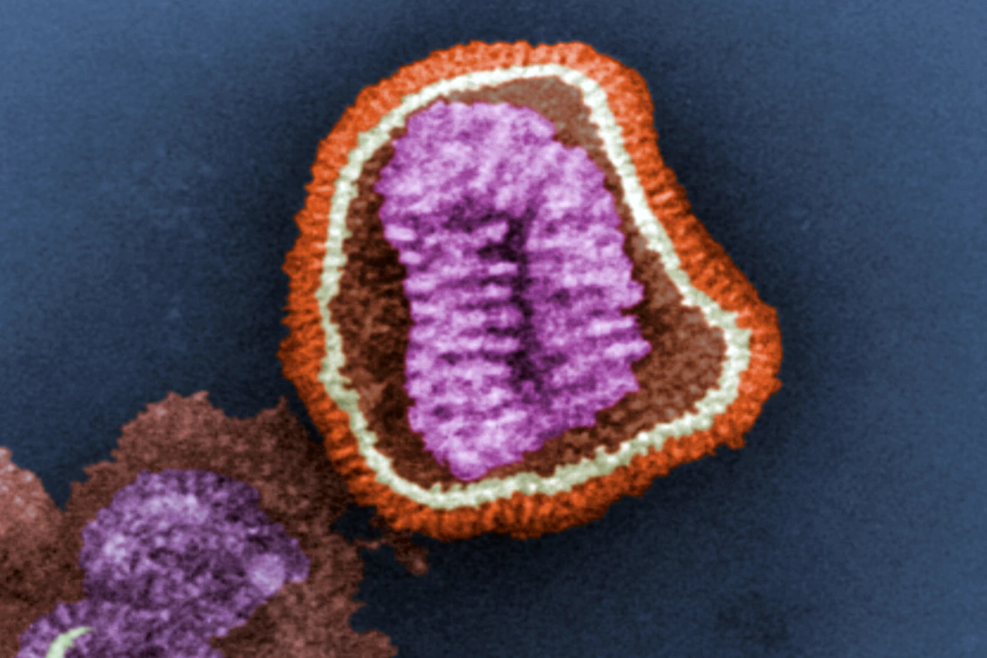 A colorized transmission electron micrograph (TEM) image of an influenza virus particle, or 'virion'