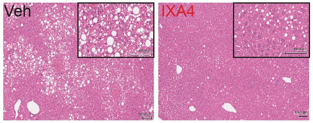 Liver fat deposits seen in untreated mice on the left, compared to mice receiving an experimental compound on the right