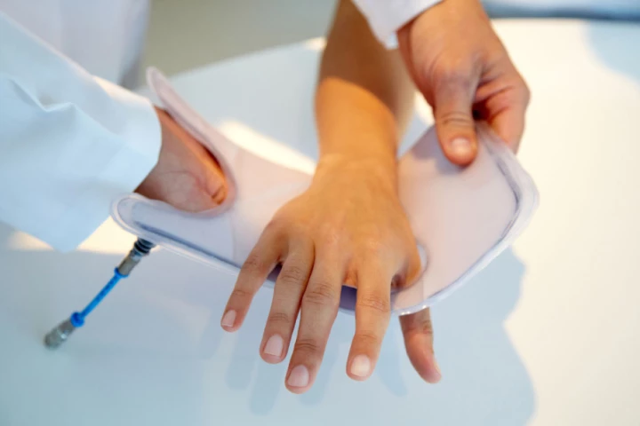 A custom-fit Varstiff wrist brace could be applied and removed in seconds, yet remain rigid while in place