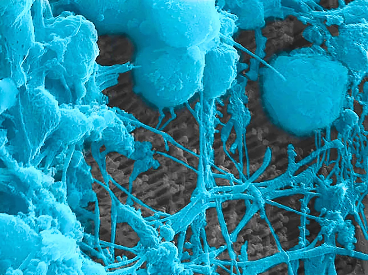 These neurons were cultured on a surface made up of nanowires, allowing them to interface with each other