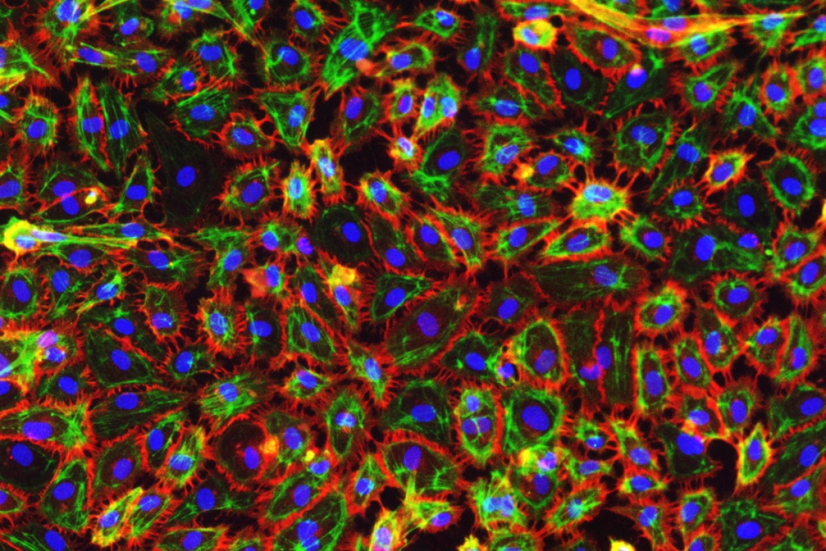 Endothelial cells grown from stem cells in the blood, stained with fluorescent markers (Photo: Imperial College)