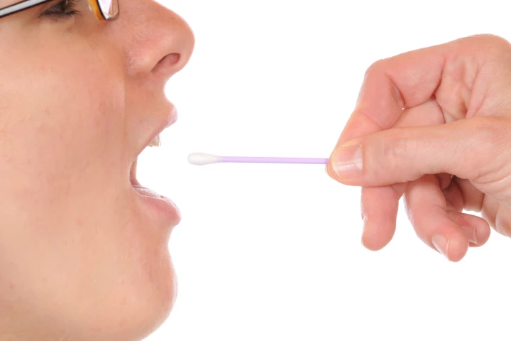 Rising HPV levels in saliva samples could be an early sign of throat cancer