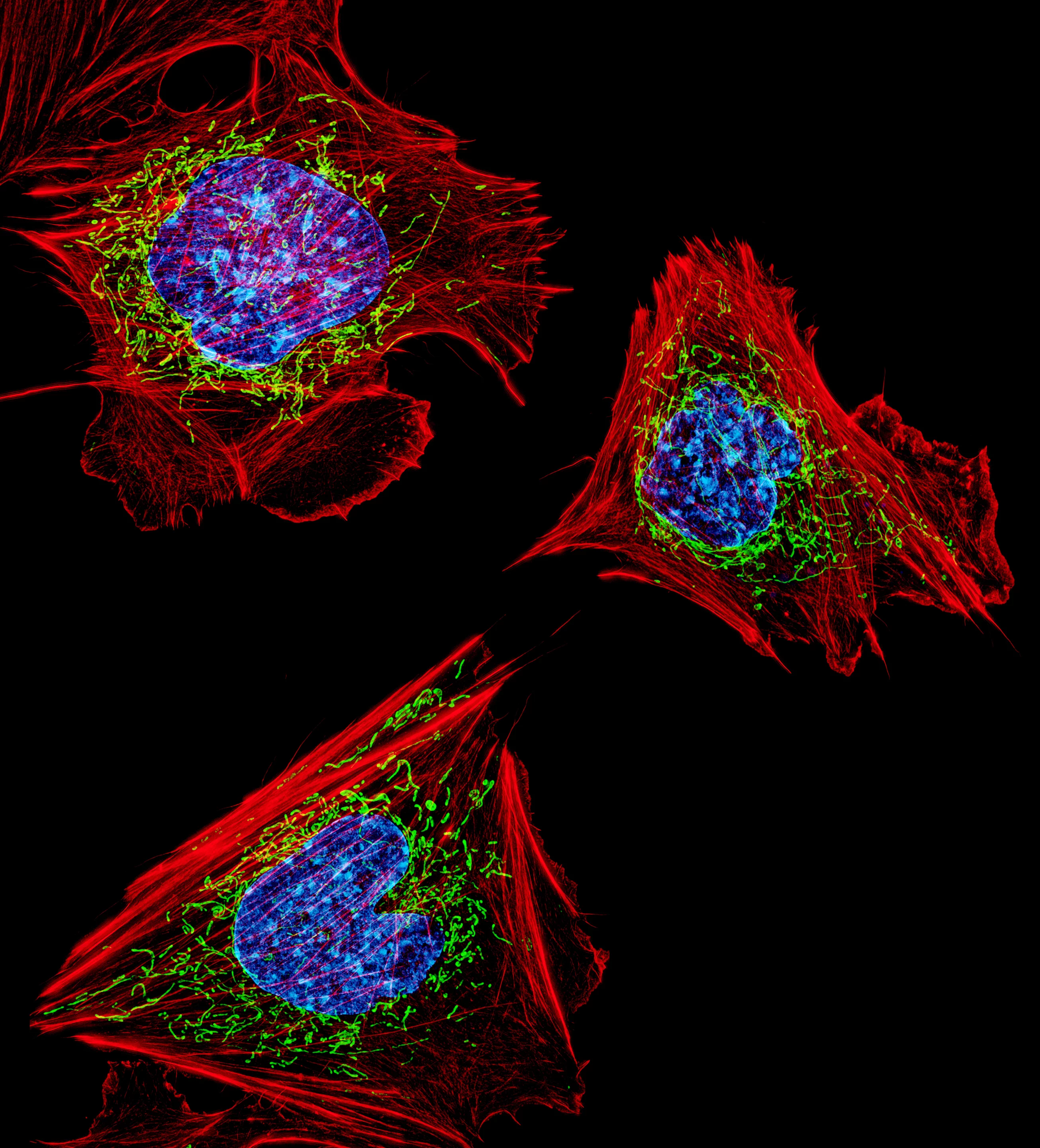 New research has found that a cell's mitochondria (represented in green above) can be affected through fasting which results in better health and longevity