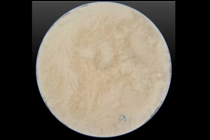 One of the agar membranes used in the study