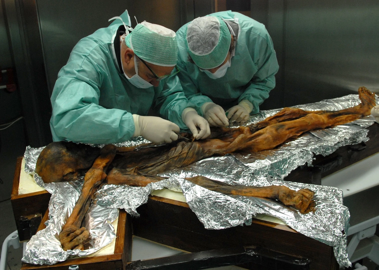 It may look like an alien autopsy, but here researchers examine the stomach contents of the 5,300-year old Iceman, Ötzi