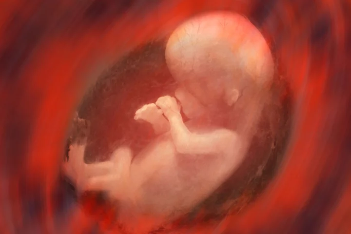 A new technique may allow stem cells to be safely harvested from amniotic fluid during birth by caesarian section