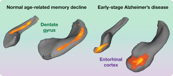 The dentate gyrus is a specific part of the brain’s hippocampus associated with normal age-related memory decline in humans and other mammals. (Photo: Columbia University Medical Center)