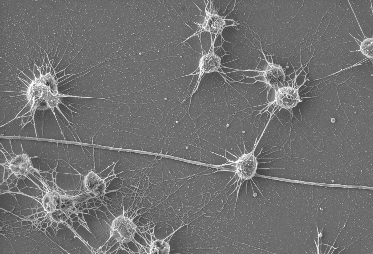 Archaea species known as Altiarchaeales, which were discovered in sulfidic springs in Germany