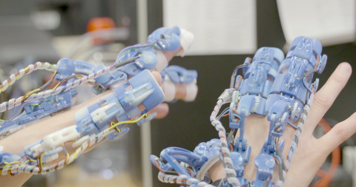 Handmounted exoskeleton system helps surgeons get a grip