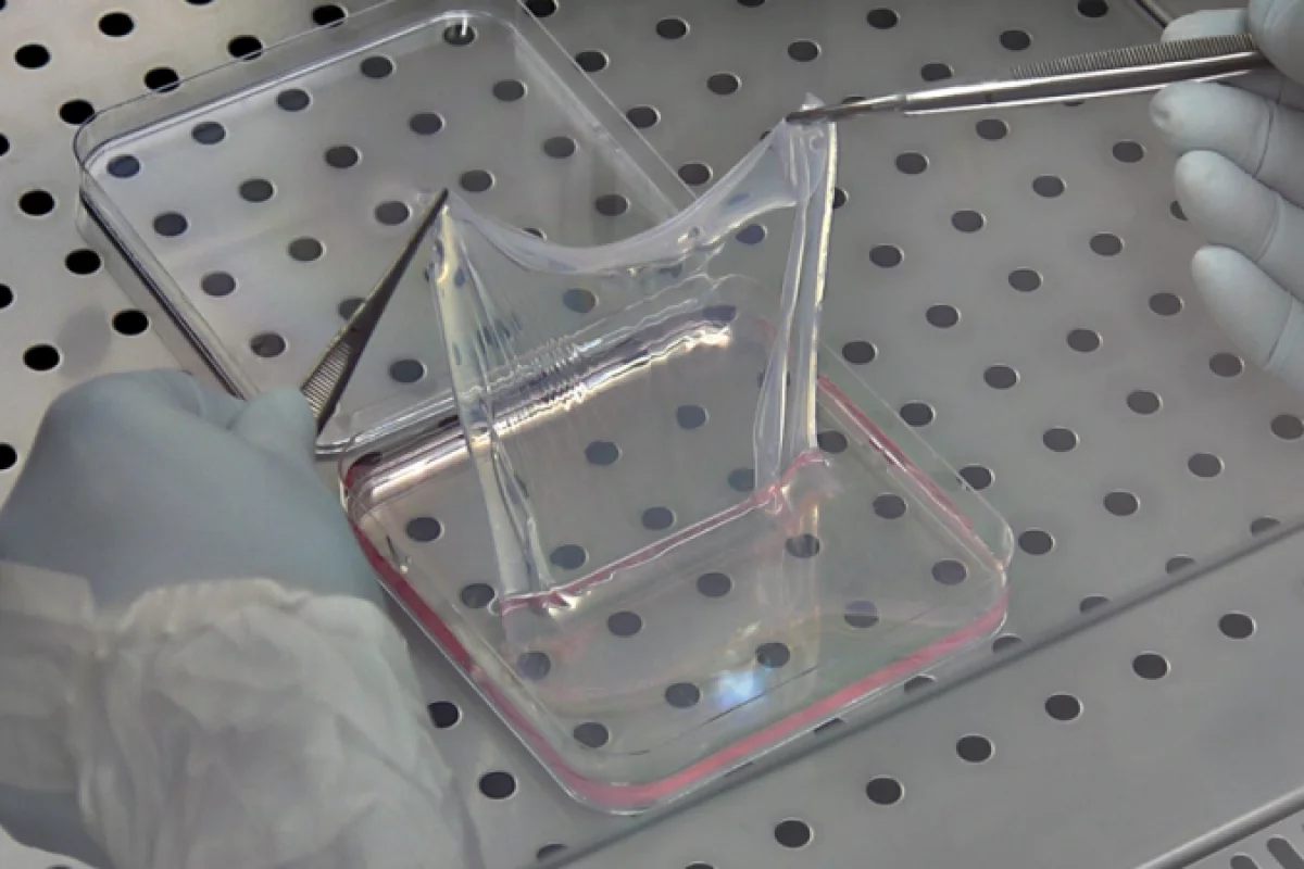 The genetically modified, laboratory-grown skin that saved a young boy's life