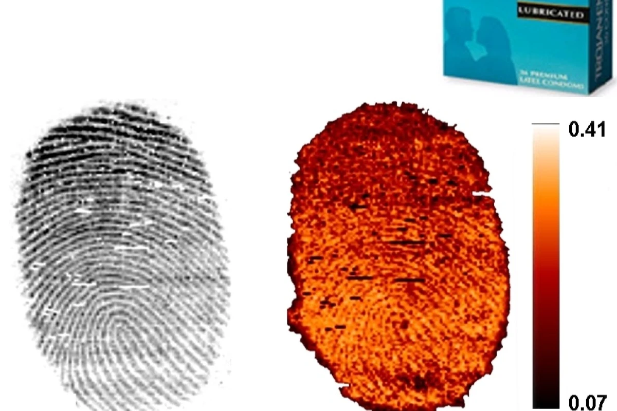 A regular fingerprint (left) and one containing condom lubricant (right) (Image: BMRC)
