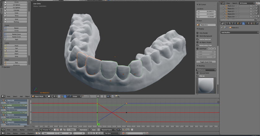 Dudley used a NextEngine 3D laser scanner to create a digital model of his teeth