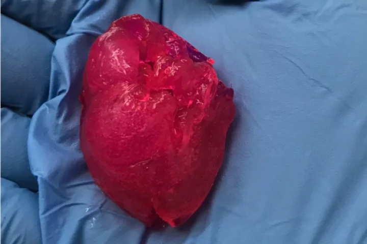 The bioprinted heart, seen here in the palm of a gloved hand