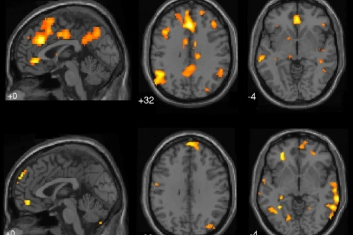 fMRI brain scans from UBC Mind Wandering Study(Image: Courtesy of Kalina Christoff)