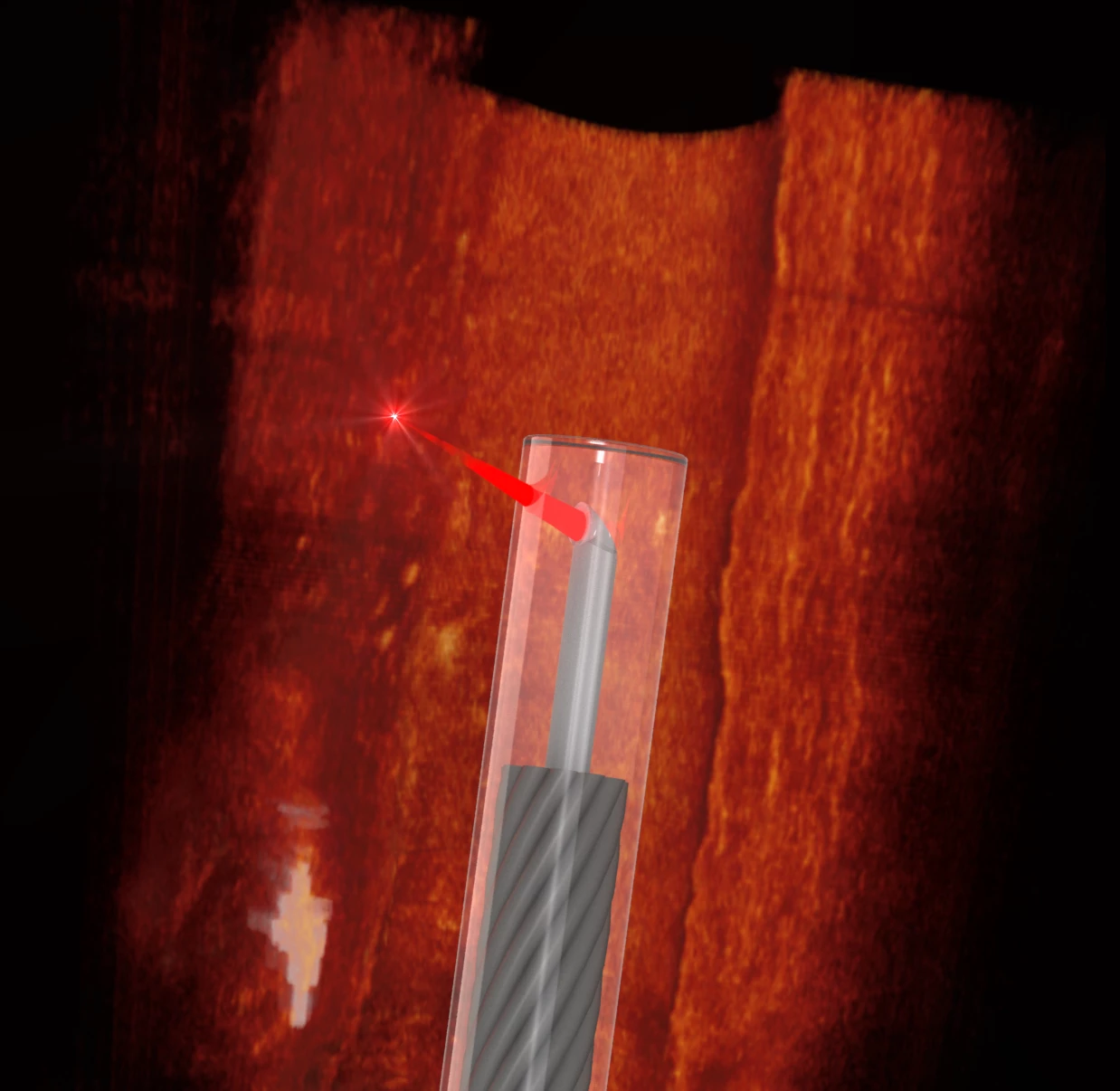 The thickness of a human hair, this optical probe has a tiny lens 3D printed into its side, allowing unprecedented 3D scanning access through blood vessels and other hard-to-reach places in the body