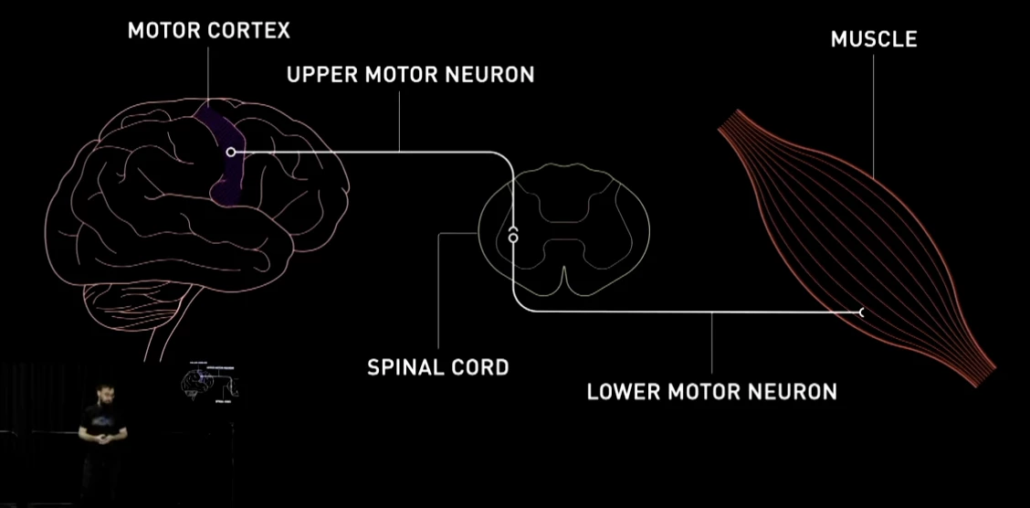 Neuralink has set itself the ambitious goal of re-routing motor and sensory signals around spinal cord injuries, hoping to restore movement and sensation to people who are paralyzed