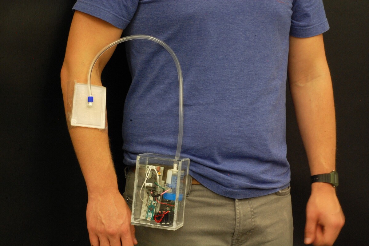 Wearable tech uses ozone gas to kill bacteria in chronic wounds