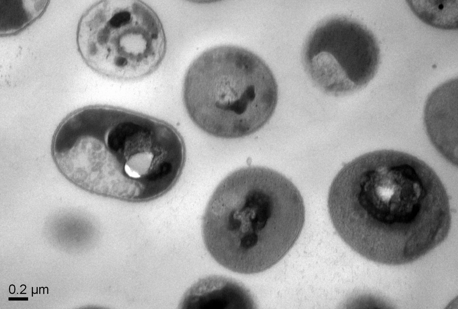 Normal cells of the Acinetobacter baumannii bacteria after treatment with the synthetic polymers, showing that the cytoplasmic substances within the bacterial cell membrane have precipitated, killing the bacteria
